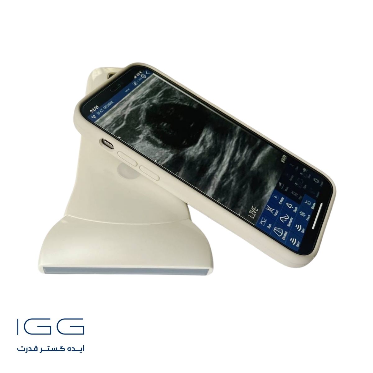 دستگاه سونوگرافی هندهلد L5WC-CPROBE L
