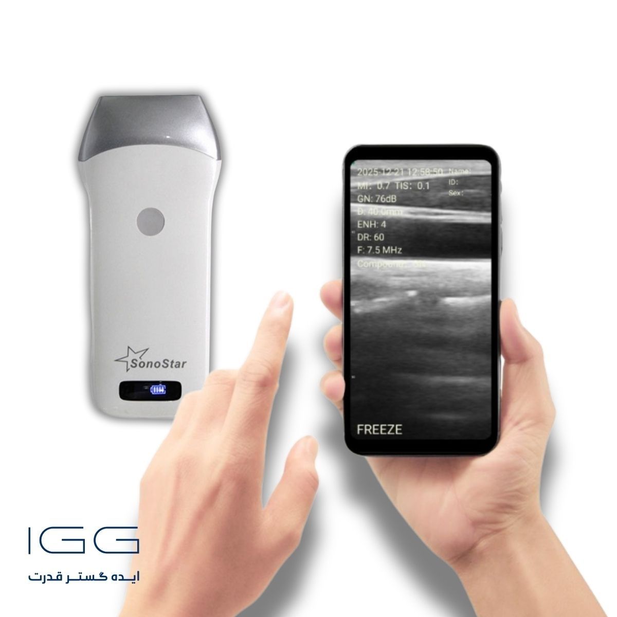 دستگاه سونوگرافی هندهلد L3-CPROBE L