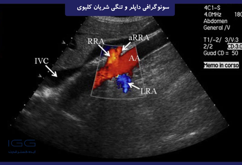 تصویر رنگی از استیوم