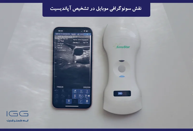 سونوگرافی با موبایل پانکراس