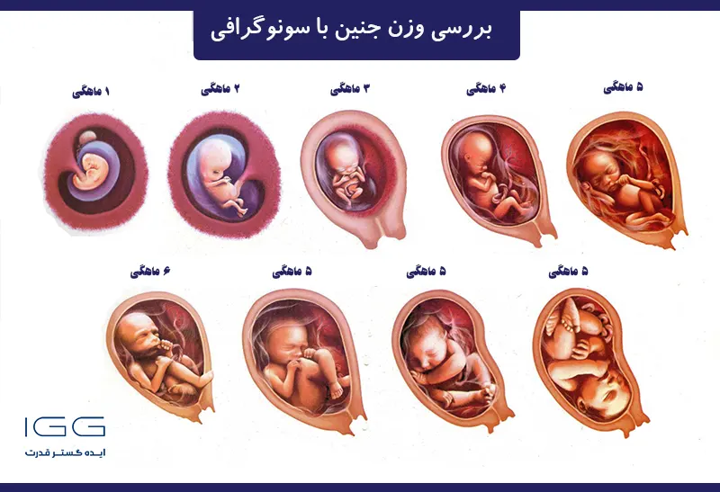 fetal weight