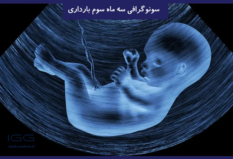 سونوگرافی سه ماهه آخر بارداری