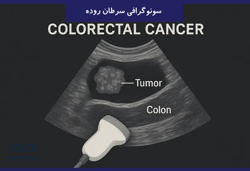 سونوگرافی سرطان روده
