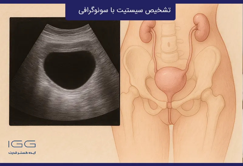 تشخیص سیستیت با سونوگرافی | روش‌ها، مزایا و نکات کاربردی