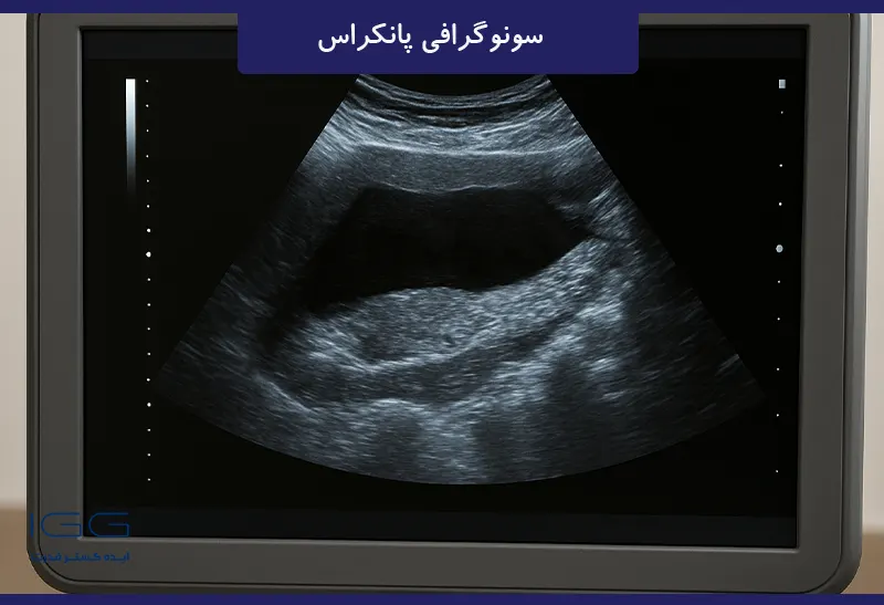 تشخیص پانکراس با سونوگرافی
