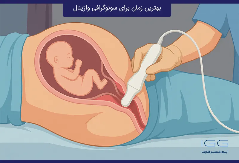 بهترین زمان سونوگرافی واژینال در بارداری