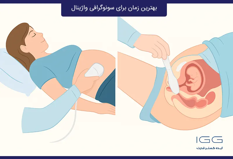 مقایسه سونوگرافی شکمی و واژینال