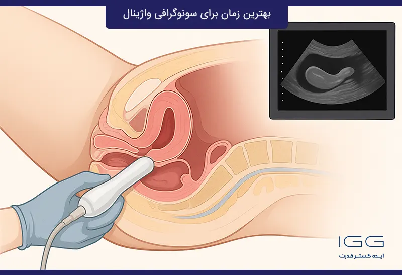 بهترین زمان برای سونوگرافی واژینال