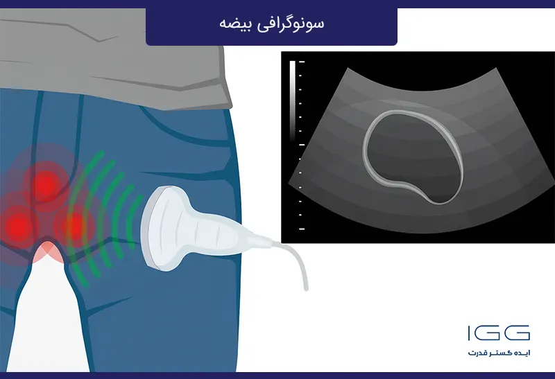 سونوگرافی بیضه چیست و چه کاربردی دارد؟