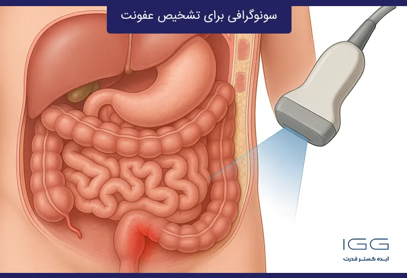 سونوگرافی برای تشخیص عفونت