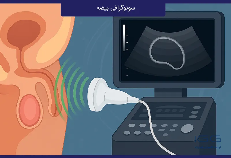 سونوگرافی بیضه