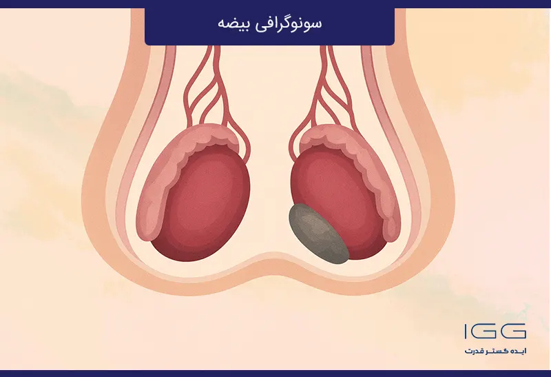 سونوگرافی بیضه و ضرورتش