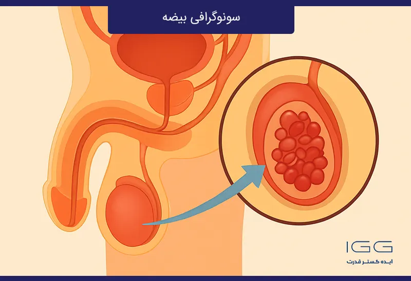 سونوگرافی بیضه