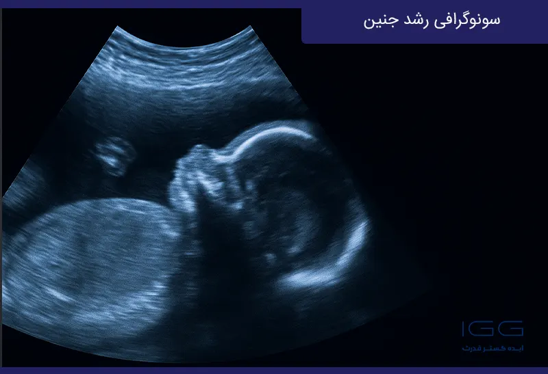 سونوگرافی IUGR و رشد جنین چیست؟