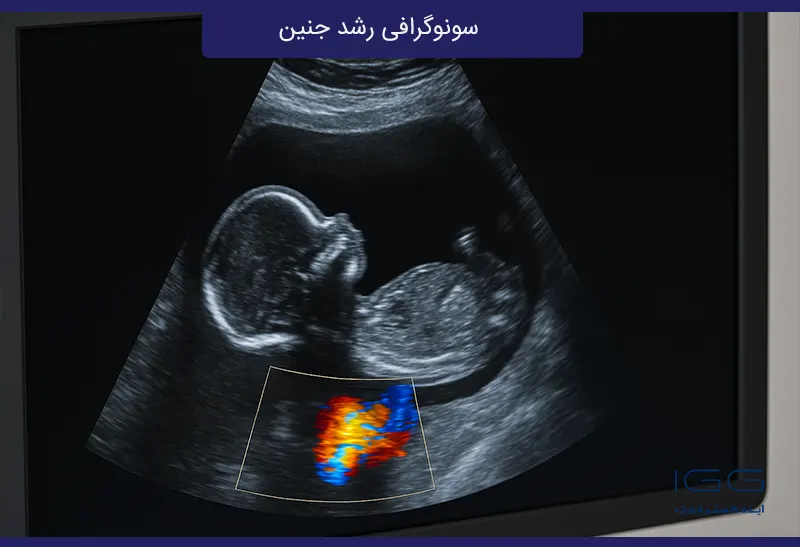 سونوگرافی IUGR و رشد جنین چیست؟