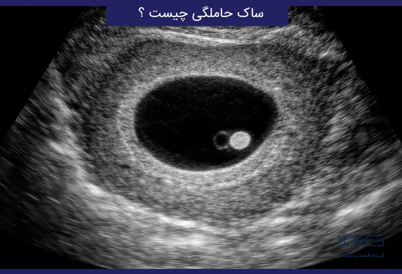 اندازه طبیعی ساک حاملگی و اهمیت آن