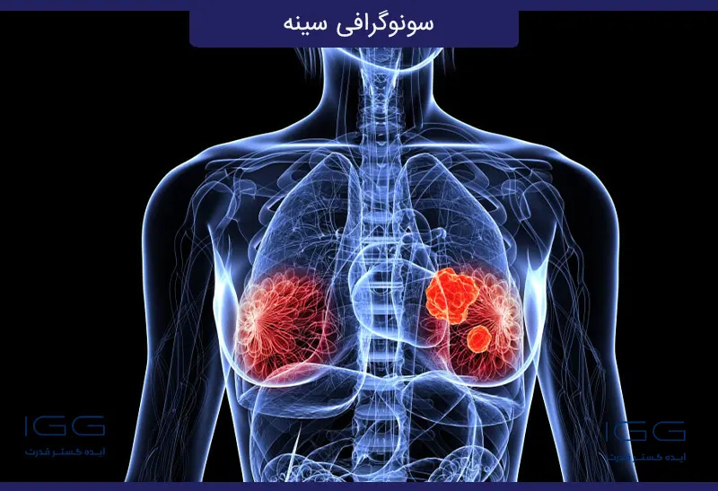 سونوگرافی سینه در چه مواردی کاربرد دارد؟