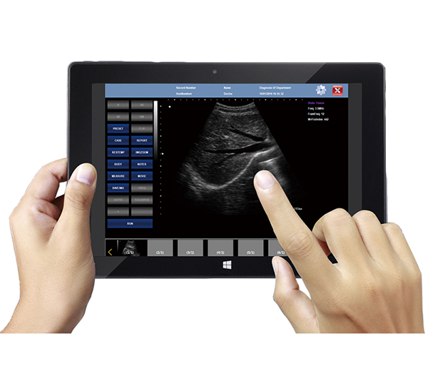 V10 Palm Ultrasound Scanner