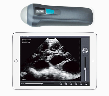 UProbe-1 Wireless Probe Ultrasound Scanner