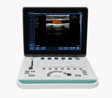 C5W Wireless Laptop Color Doppler