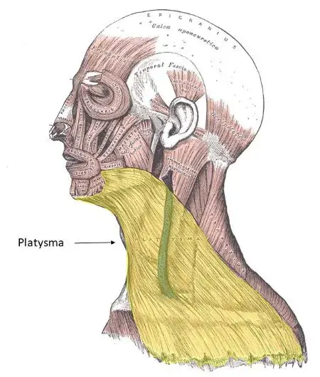 عضله پلاتیسما
