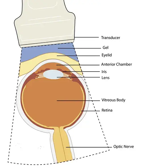 آناتومی سونوگرافی چشم