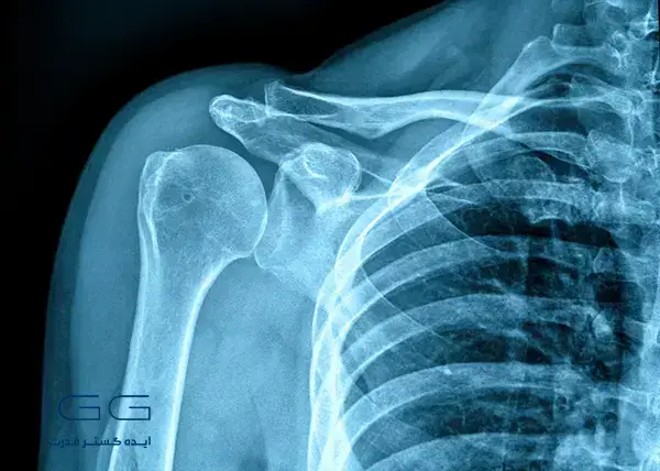 اسکن ایکس (X-ray)
